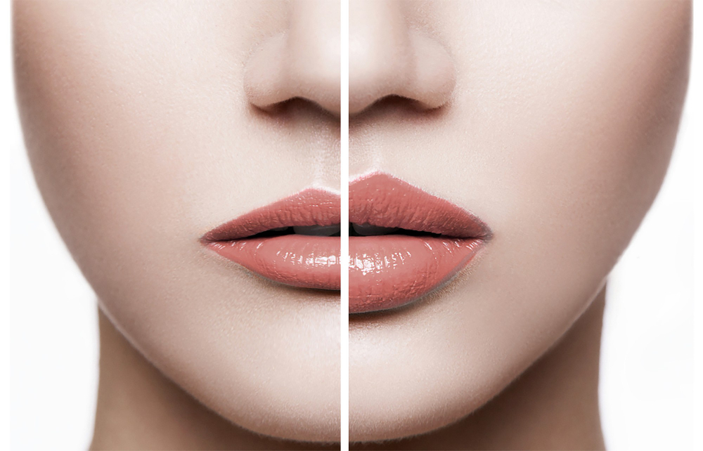 closeup-female-lips-before-after-augmentation-procedure-beauty-concept-human-beauty-treatment-care.jpg