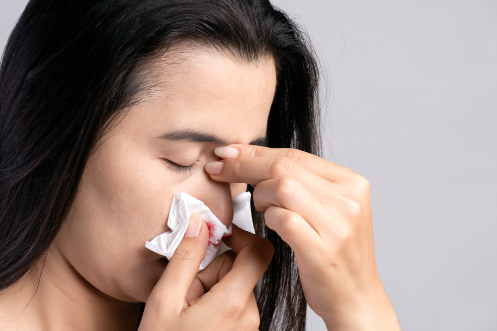 nosebleed-woman-suffering-from-nose-bleeding-using-tissue-paper.jpg